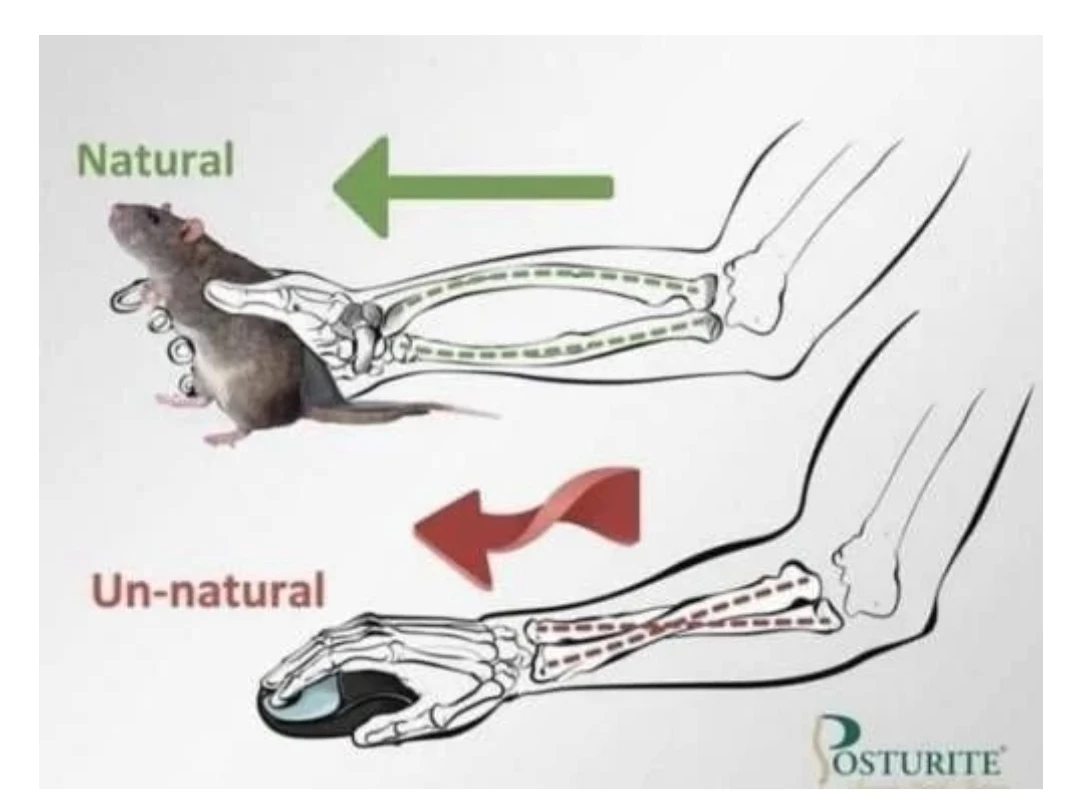 Why do you have carpal tunnel syndrome because of the mouse?