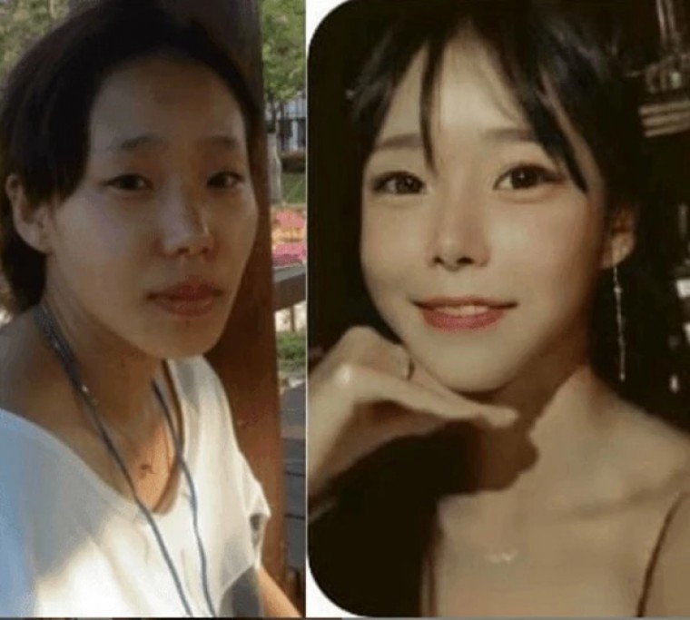 Gapyeong Valley Murder Suspect Before and After Plastic Surgery Jpg