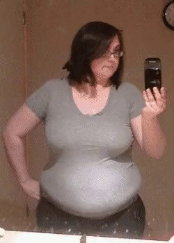 Changes in the Diet Body of a Highly Obese Woman GIF