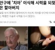 Grandfather who regained his eyesight through tooth decay in his eyes