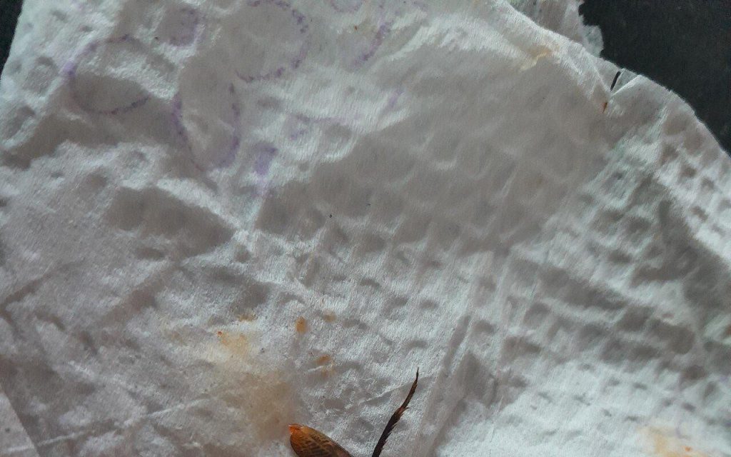 I was eating chicken and I got a cockroach leg. What should I do?Photo attached