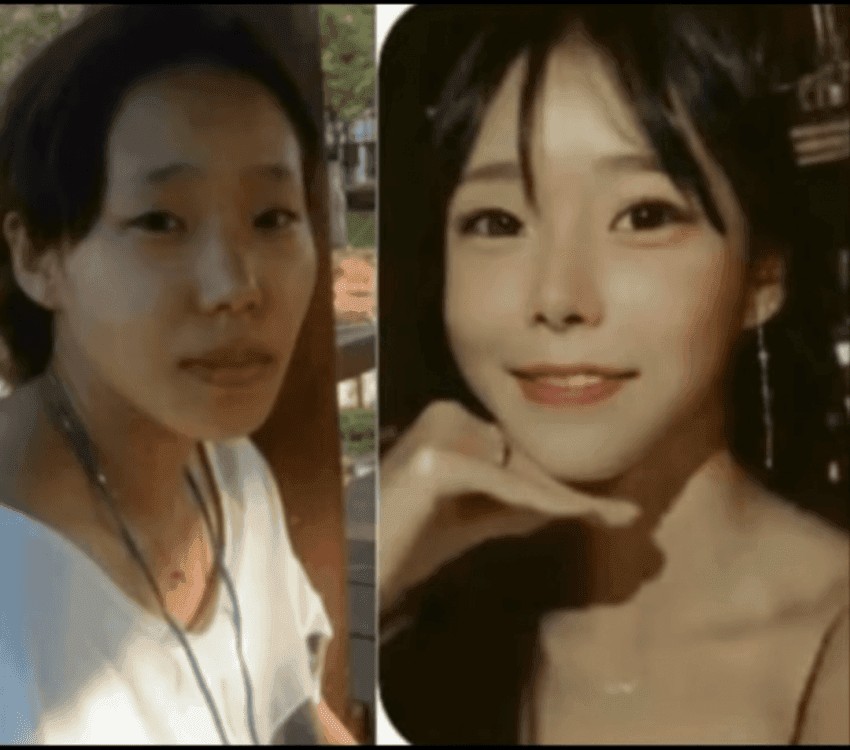 Valley Murder Lee Eun-hae's Plastic Surgery