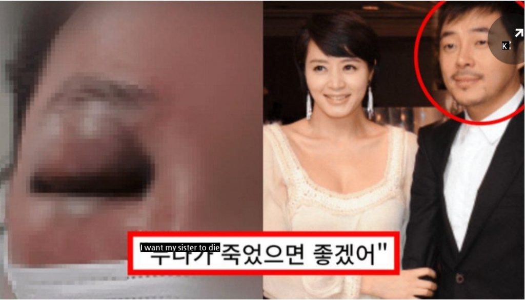 The reason why Kim Hye-soo cut her brother off