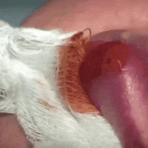 Remove Parasite from the Lips