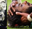 The Saudi player injured in the match against Argentina has a complete facial fracture