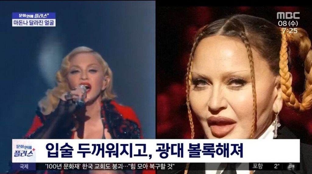 Madonna's face has changed.
