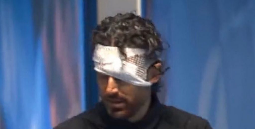 Anti-Olympic Lyon coach Fabio Grosso is attacked with a stone from a fan on the move