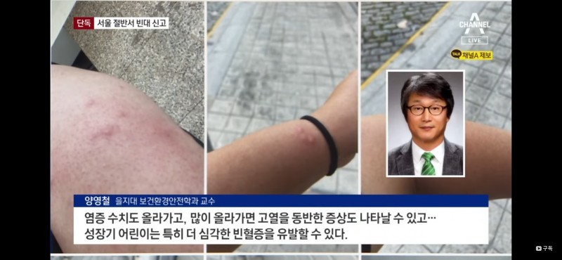 Half-pierced in Seoul with bedbugs.jpg