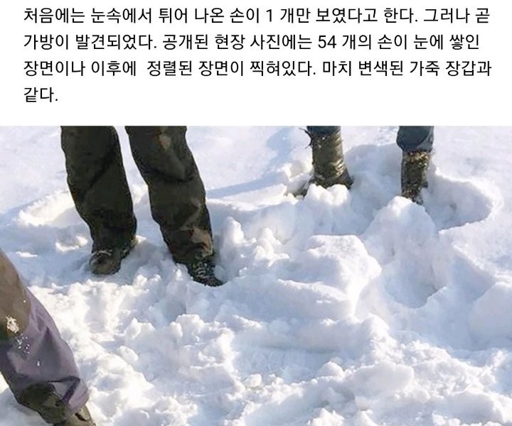 54 Human Wrist Found in Pharmacopathy Siberia
