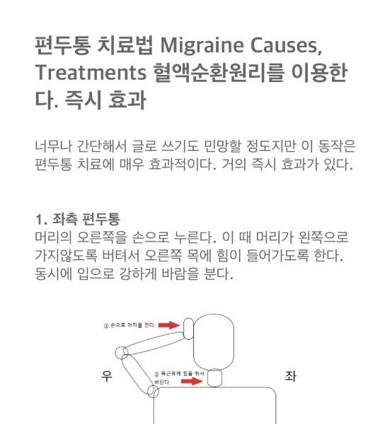 immediate treatment for migraine