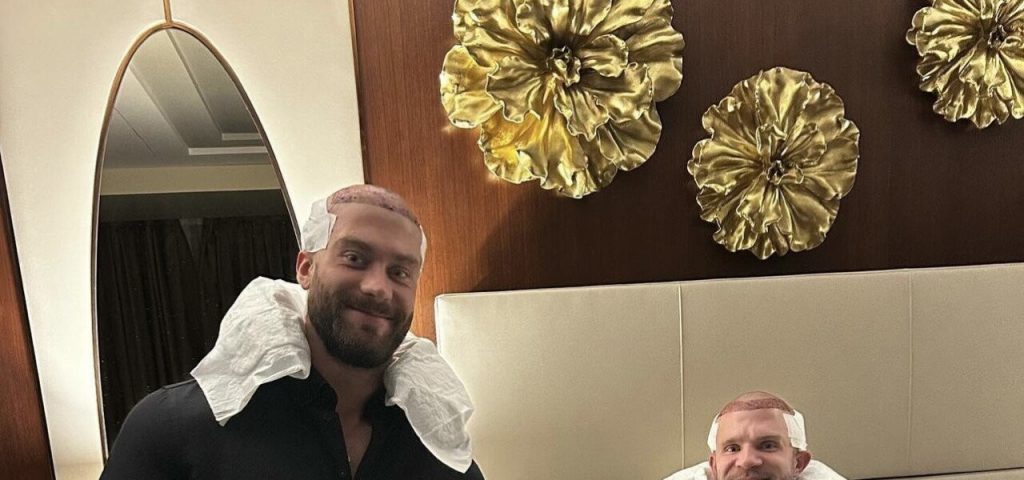 Chris Bumstead C.B.I. Hair Transplant in Turkey