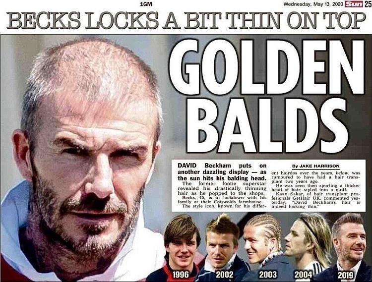 It's not Zidane. It's Beckham with hair loss