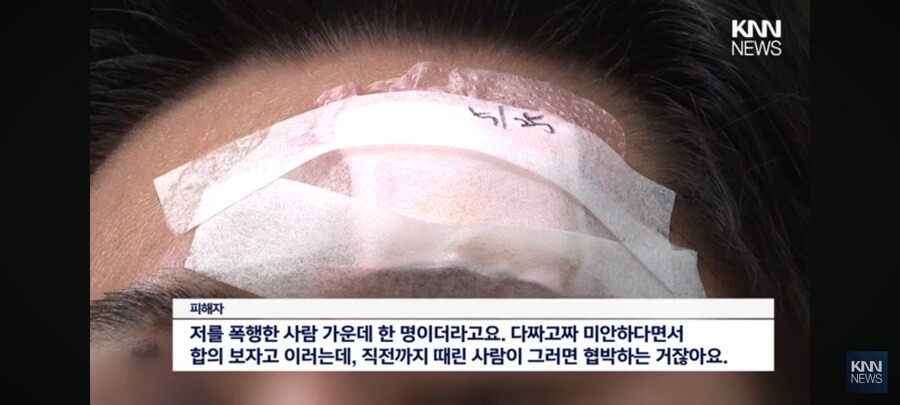 [News] Busan police neglect gangsters who indiscriminately assaulted citizens